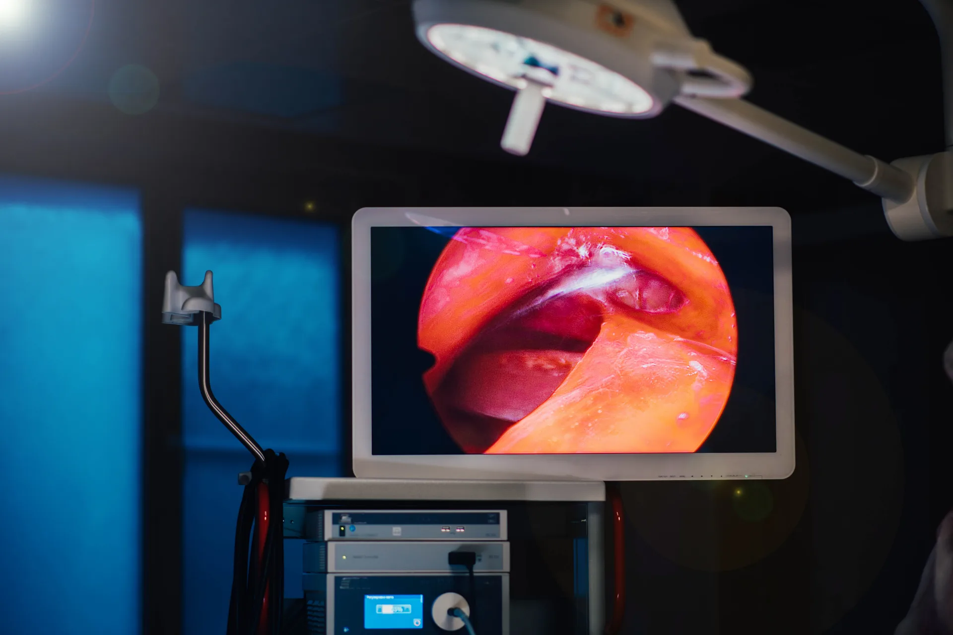 Bending assembly solution for gastrointestinal endoscopes